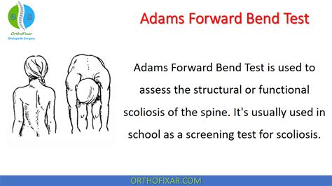 adams and cobbs test|adams forward bend test positive.